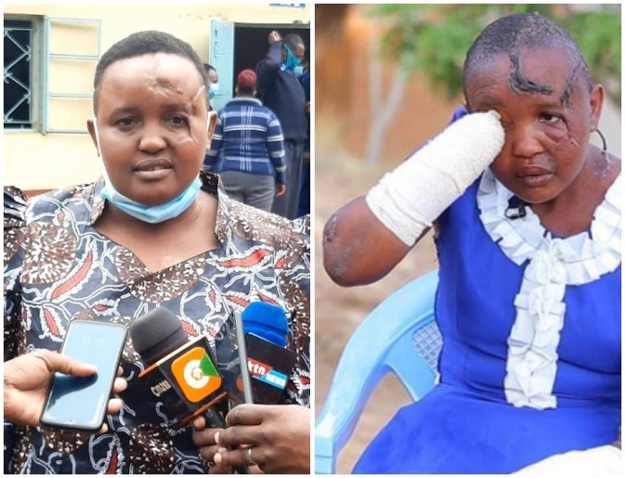 Jackline Mwende Recounts How One-Night Stand Caused Her To Lose Her Hands After Husband Is Convicted 